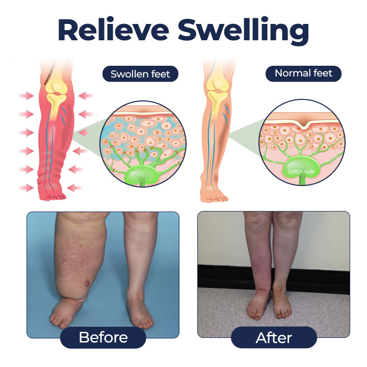 NEYEROS® SwellRelief Circulation Support Cream