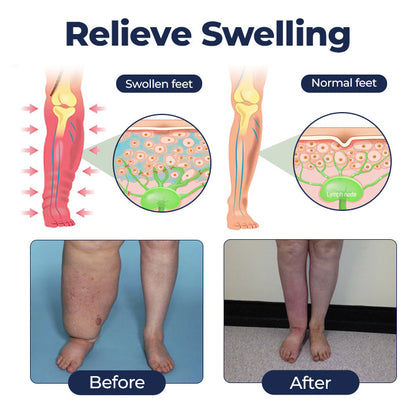 NEYEROS® SwellRelief Circulation Support Cream